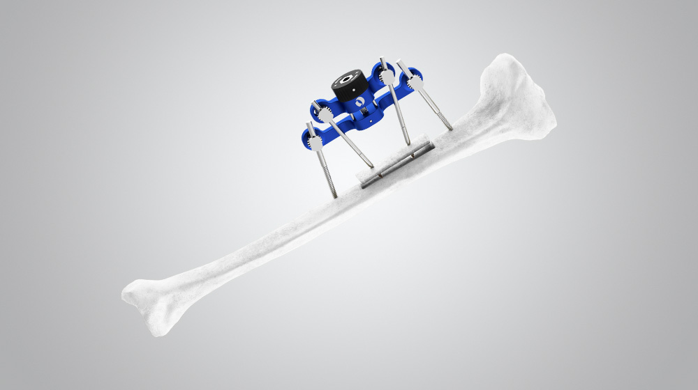 MAGNUM SURGICAL SOLUTIONS